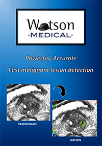 Powerful, Accurate, Fast malignant lesion detection